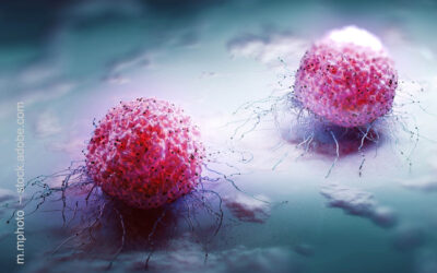Hemmstoff macht Tumorzellen unbeweglich