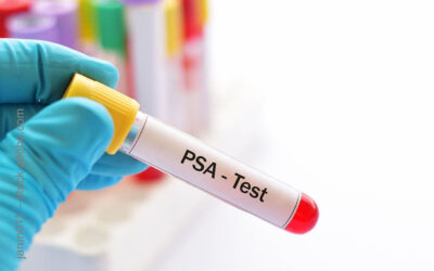 PSA-Tests ab 55 Jahre senken Sterberisiko bei Prostatakrebs